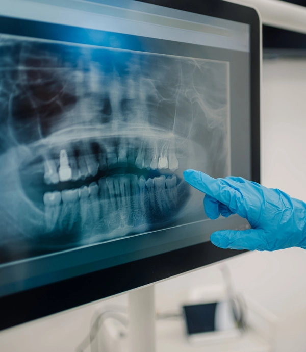 Digital X Rays at [practice_name]