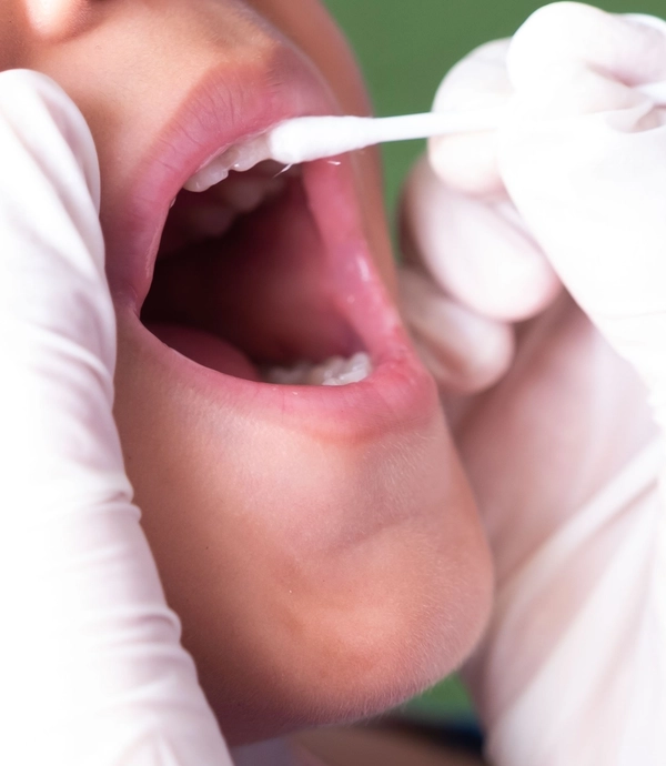 Fluoride Treatment at [practice_name]