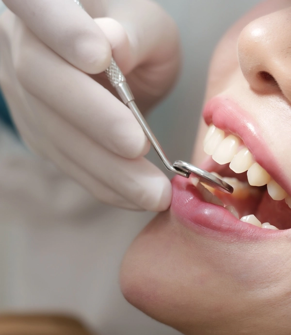 In Office Teeth Whitening at [practice_name]