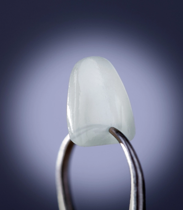 Lumineers® at [practice_name]