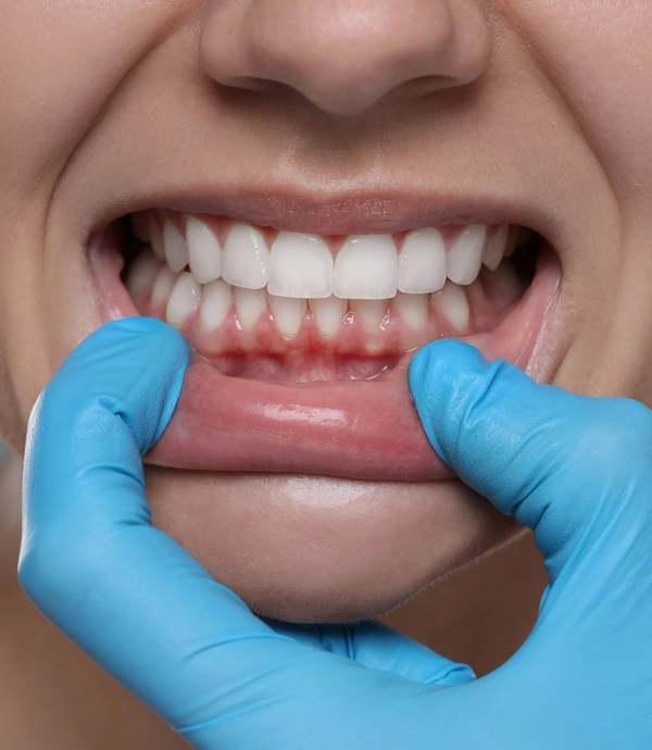 Periodontics services at [practice_name]