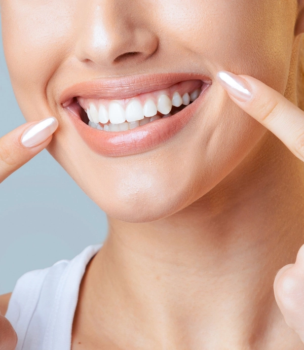 Smile Makeover at [practice_name]