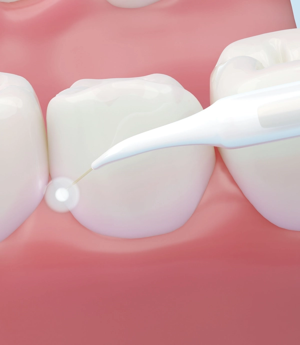 soft tissue laser therapy at [practice_name]