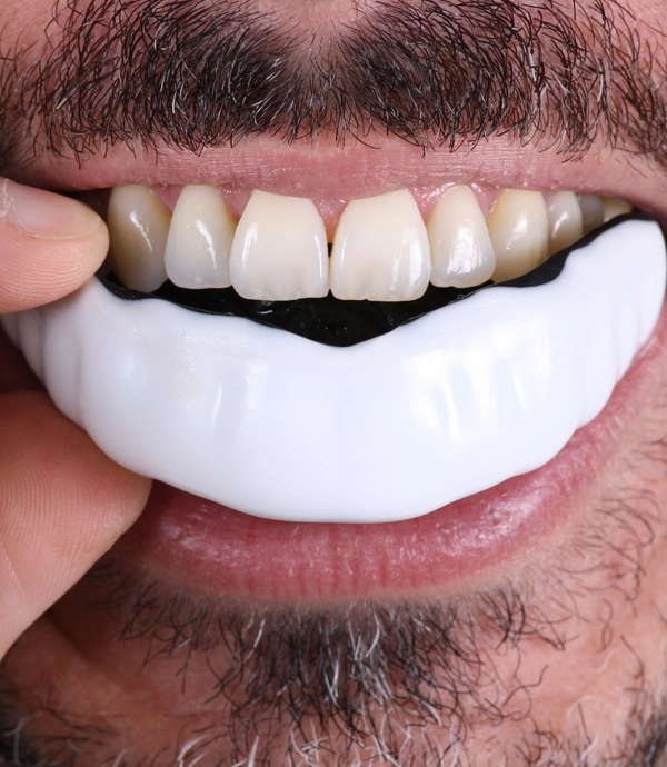 Sports Mouth Guards at [practice_name]